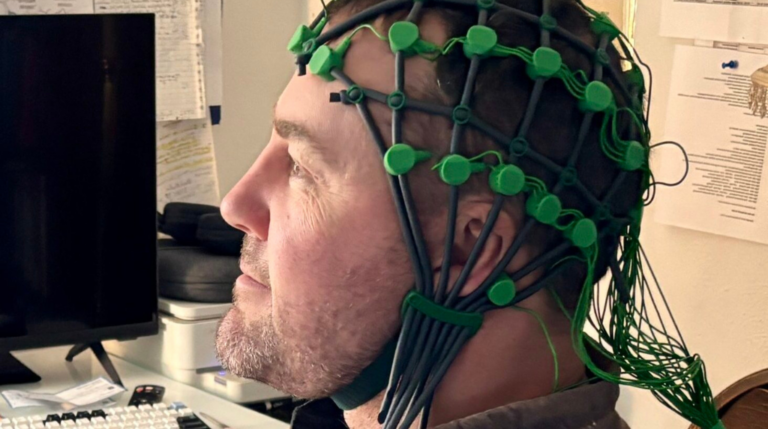 QEEG Brain Mapping