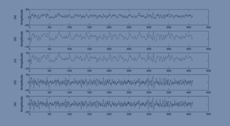 Baseline EEG