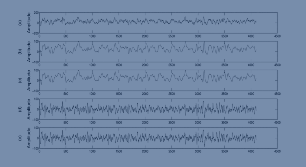 Baseline EEG